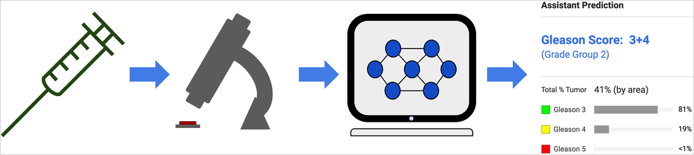 Cancer pathology workflow